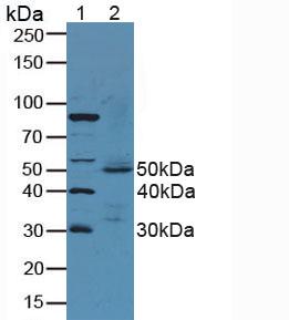Polyclonal Antibody to Gastric Intrinsic Factor (GIF)