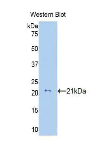 Polyclonal Antibody to Collagen Type VIII Alpha 2 (COL8a2)