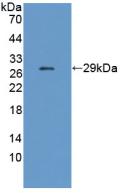 Polyclonal Antibody to Cholinergic Receptor, Nicotinic, Epsilon (CHRNe)
