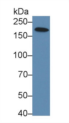 Polyclonal Antibody to 5'-3'Exoribonuclease 1 (XRN1)
