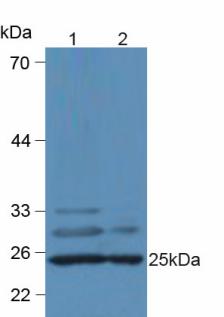 Polyclonal Antibody to Complement Component 1, Q Subcomponent A (C1qA)