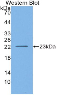 Polyclonal Antibody to Lipase A, Lysosomal Acid (LIPA)