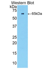 Polyclonal Antibody to Troponin C Type 2, Fast (TNNC2)