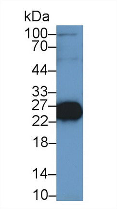 Polyclonal Antibody to Troponin I Type 2, Fast Skeletal (TNNI2)