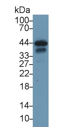 Polyclonal Antibody to Troponin T Type 2, Cardiac (TNNT2)