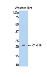 Polyclonal Antibody to Ferritin, Mitochondrial (FTMT)