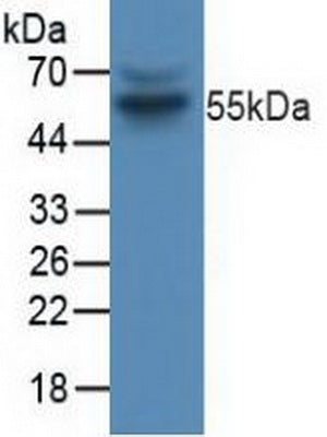Polyclonal Antibody to Cyclin B (CCNB)