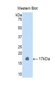 Polyclonal Antibody to Left/Right Determination Factor 2 (LEFTY2)