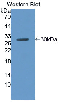 Polyclonal Antibody to Amiloride Sensitive Sodium Channel Subunit Gamma (SCNN1g)