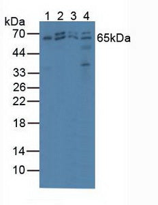 Polyclonal Antibody to Protein Kinase, AMP Activated Alpha 2 (PRKAa2)