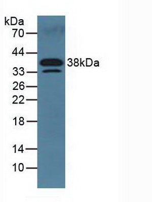 Polyclonal Antibody to Dickkopf Related Protein 3 (DKK3)
