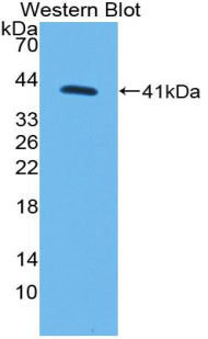Polyclonal Antibody to Myosin VA (MYO5A)