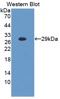 Polyclonal Antibody to Myosin Light Chain Kinase 2 (MYLK2)