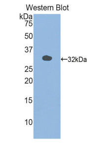 Polyclonal Antibody to Myosin Light Chain Kinase 3 (MYLK3)