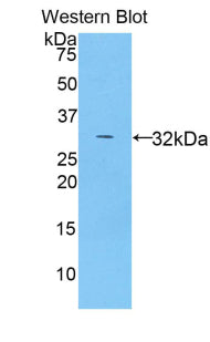 Polyclonal Antibody to Myosin IB (MYO1B)