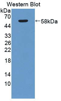 Polyclonal Antibody to Myosin IC (MYO1C)