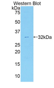 Polyclonal Antibody to Myosin IC (MYO1C)