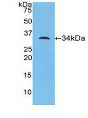 Polyclonal Antibody to Myosin ID (MYO1D)