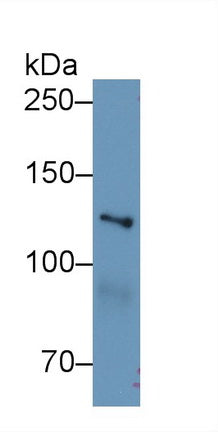 Polyclonal Antibody to Myosin IE (MYO1E)