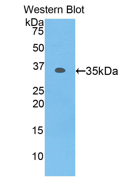 Polyclonal Antibody to Myosin IF (MYO1F)