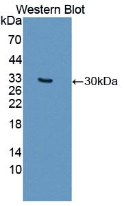 Polyclonal Antibody to Myosin IF (MYO1F)