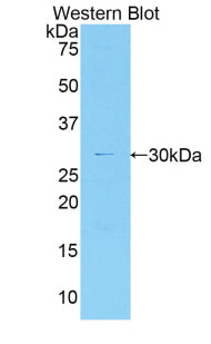 Polyclonal Antibody to Myosin IG (MYO1G)