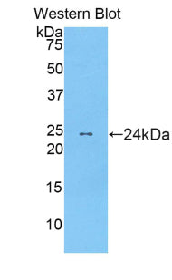Polyclonal Antibody to Myosin Light Chain 12B (MYL12B)