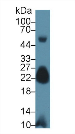 Polyclonal Antibody to Myosin Light Chain 7, Regulatory (MYL7)