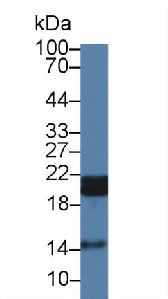 Polyclonal Antibody to Heat Shock Protein Beta 7 (HSPb7)