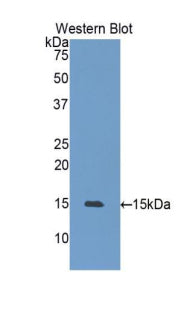 Polyclonal Antibody to Heat Shock 105kDa/110kDa Protein 1 (HSPH1)