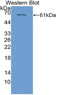 Polyclonal Antibody to Cytochrome P450 26B1 (CYP26B1)