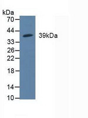 Polyclonal Antibody to Mitogen Activated Protein Kinase Kinase 3 (MAP2K3)