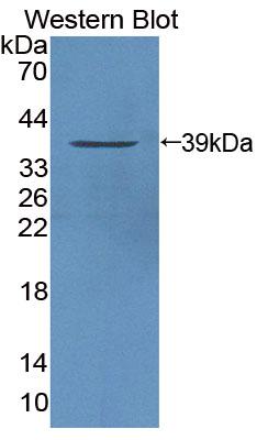 Polyclonal Antibody to Protein Tyrosine Phosphatase, Non Receptor Type 9 (PTPN9)
