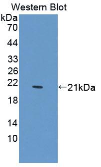 Polyclonal Antibody to Protein Tyrosine Phosphatase, Non Receptor Type 13 (PTPN13)