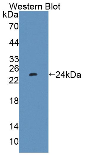 Polyclonal Antibody to Protein Tyrosine Phosphatase Type IVA 1 (PTP4A1)