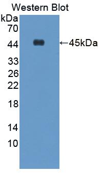 Polyclonal Antibody to Acetyl Coenzyme A Acetyltransferase 1 (ACAT1)