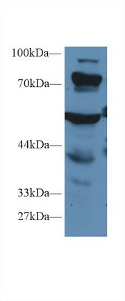 Polyclonal Antibody to Propionyl Coenzyme A Carboxylase Alpha (PCCa)