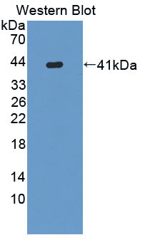 Polyclonal Antibody to Keratin 6C (KRT6C)