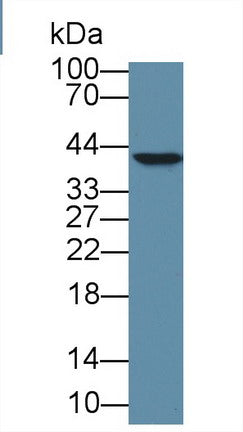 Polyclonal Antibody to High Mobility Group Protein 20B (HMG20B)