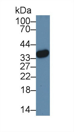Polyclonal Antibody to High Mobility Group Protein 20B (HMG20B)