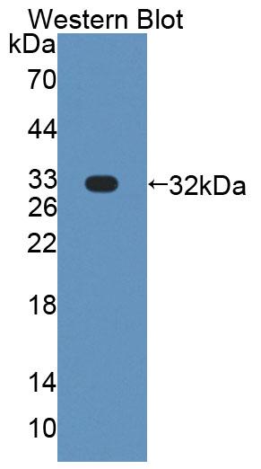 Polyclonal Antibody to Phospholipase C Eta 1 (PLCh1)