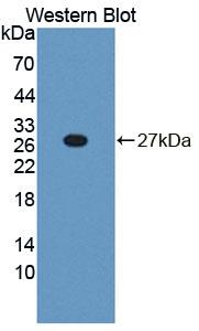 Polyclonal Antibody to Phospholipase C Like Protein 1 (PLCL1)