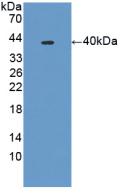Polyclonal Antibody to Phospholipase A2 Receptor 1 (PLA2R1)