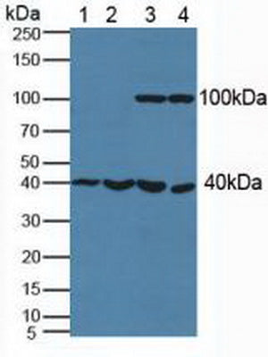 Polyclonal Antibody to Phosphoserine Aminotransferase 1 (PSAT1)