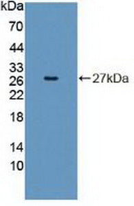 Polyclonal Antibody to Insulin Receptor Related Receptor (INSRR)