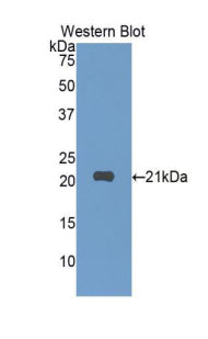 Polyclonal Antibody to Sialic Acid Binding Ig Like Lectin 10 (SIGLEC10)