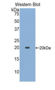 Polyclonal Antibody to Sialic Acid Binding Ig Like Lectin 9 (SIGLEC9)