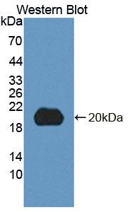 Polyclonal Antibody to 5',3'-Nucleotidase, Cytosolic (NT5C)