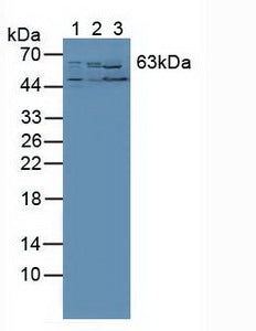 Polyclonal Antibody to RAR Related Orphan Receptor Alpha (RORa)