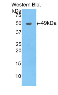 Polyclonal Antibody to Pregnane X Receptor (PXR)